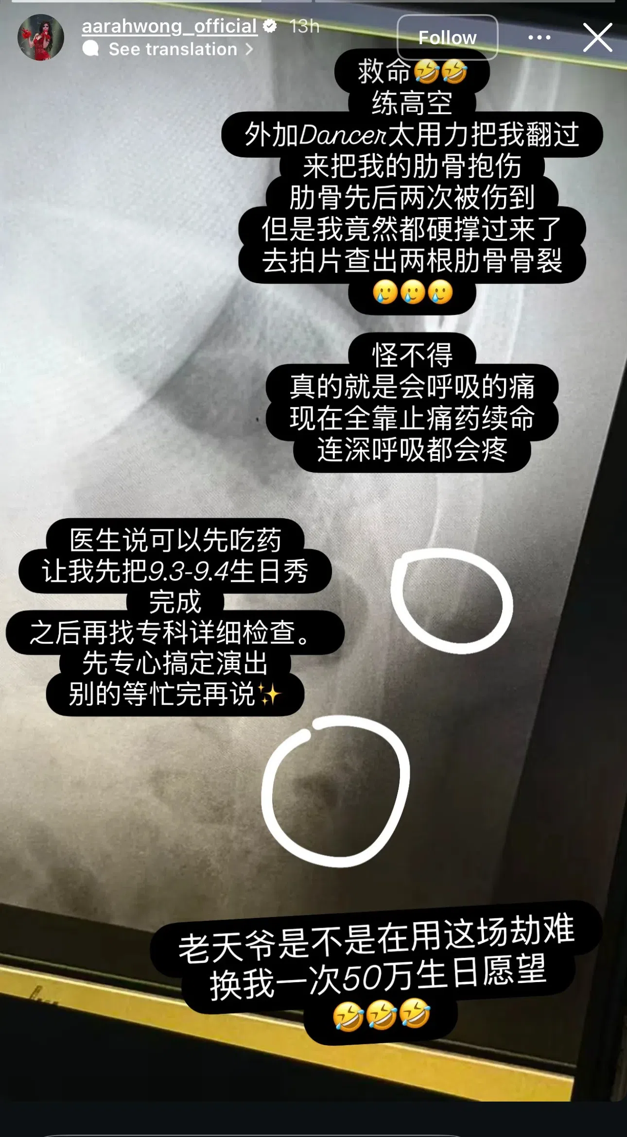 渲瀛8月31日在Instagram透露排练时受伤，导致两根肋骨骨裂。（渲瀛Instagram）